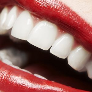 Dental Check-Up With Optional Stain Removal, Or Laser Teeth Whitening DENTISTRY Shop Online at Special Price from Dubai Shopping City