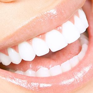 Scaling And Polishing With X-Ray At Omar Yahia Dental Surgery Clinic DENTISTRY Shop Online at Special Price from Dubai Shopping City